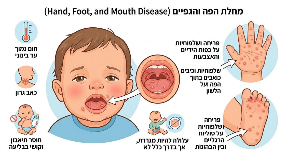 מחלת הפה והגפיים (תמונה: גוגל ג'מיני)